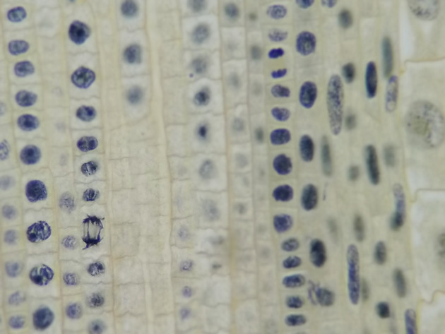 Onion Root Mitosis Slides - Onion Root  Mitosis  09 400X